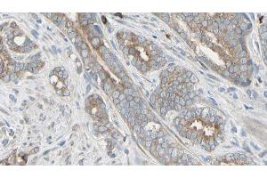 ABIN6276497 at 1/100 staining Human prostate tissue by IHC-P. (AMBRA1 anticorps  (C-Term))