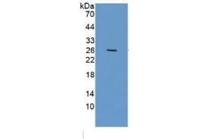 WB of Protein Standard: different control antibodies against Highly purified E.