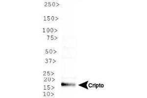 Image no. 2 for anti-Teratocarcinoma-Derived Growth Factor 1 (TDGF1) (N-Term) antibody (ABIN363493) (TDGF1 anticorps  (N-Term))
