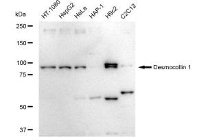 anti-Desmocollin 1 (DSC1) antibody