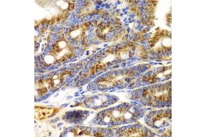 Immunohistochemistry of paraffin-embedded mouse Intestine using TNFSF11 antibody (ABIN6290161) at dilution of 1:100 (40x lens). (RANKL anticorps)