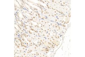 Immunohistochemistry of paraffin-embedded mouse stomach using SOCS1 Rabbit mAb (ABIN7270640) at dilution of 1:100 (40x lens). (SOCS1 anticorps)