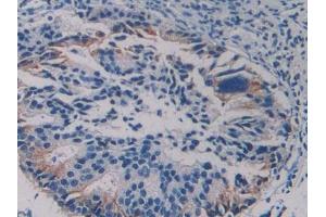 Used in DAB staining on fromalin fixed paraffin- embedded human liver tissue (CCL5 anticorps  (AA 24-91))