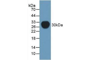 Detection of Recombinant Pgp, Mouse using Polyclonal Antibody to Permeability Glycoprotein (Pgp) (Permeability Glycoprotein anticorps  (AA 391-627))