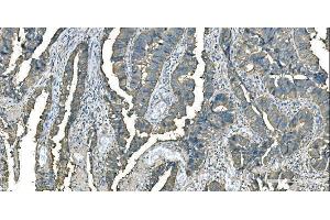 IHC analysis of Aspartate Aminotransferase/GOT1 using anti-Aspartate Aminotransferase/GOT1 antibody (ABIN7601883). (GOT1 anticorps  (AA 5-413))