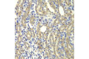 Immunohistochemistry of paraffin-embedded rat kidney using KBTBD7 antibody (ABIN5975133) at dilution of 1/100 (40x lens). (KBTBD7 anticorps)