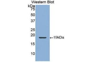 Western Blotting (WB) image for anti-Keratin 9 (KRT9) (AA 315-456) antibody (ABIN3208415) (KRT9 anticorps  (AA 315-456))