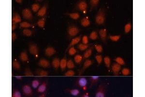 Immunofluorescence analysis of HeLa cells using CDK11B Polyclonal Antibody at dilution of 1:100. (CDK11 anticorps)