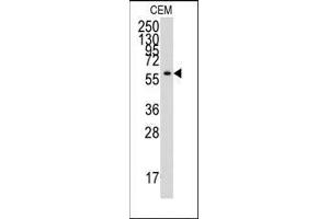 Western blot analysis of anti-YARS Antibody (C-term) in CEM cell line lysates (35ug/lane).