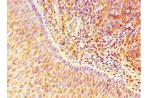 Immunohistochemistry of paraffin-embedded human tonsil tissue using ABIN7172265 at dilution of 1:100 (TLR1 anticorps  (AA 20-270))