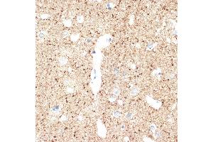 Immunohistochemistry of paraffin-embedded human brain using V Rabbit mAb (ABIN7271312) at dilution of 1:100 (40x lens). (VAMP1 anticorps)