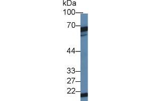 Western blot analysis of Mouse Testis lysate, using Mouse DKC Antibody (1 µg/ml) and HRP-conjugated Goat Anti-Rabbit antibody ( (DKC1 anticorps  (AA 298-509))