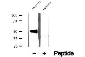 Western blot analysis of extracts of NIH/3T3 cells, using CREST antibody. (SS18L1 anticorps)