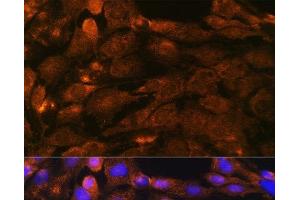 Immunofluorescence analysis of C6 cells using PTCH1 Polyclonal Antibody at dilution of 1:100. (Patched 1 anticorps)