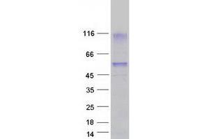 Validation with Western Blot (HAVCR1 Protein (Transcript Variant 1) (Myc-DYKDDDDK Tag))