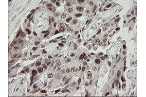 Image no. 10 for anti-Replication Factor C (Activator 1) 2, 40kDa (RFC2) (AA 1-234) antibody (ABIN1490616)