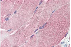 Human Skeletal Muscle (formalin-fixed, paraffin-embedded) stained with THBS1 antibody ABIN337292 at 10 ug/ml followed by biotinylated anti-mouse IgG secondary antibody ABIN481714, alkaline phosphatase-streptavidin and chromogen.