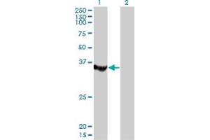 Western Blot analysis of MTMR1 expression in transfected 293T cell line by MTMR1 monoclonal antibody (M01), clone 1F10. (MTMR1 anticorps  (AA 39-112))