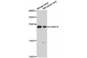 Western blot analysis of extracts of various cell lines, using CDKN1A antibody (ABIN5970693) at 1/1000 dilution. (p21 anticorps)