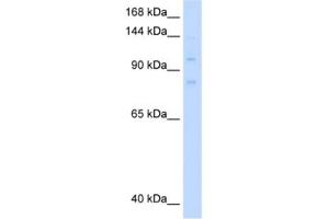 Western Blotting (WB) image for anti-Minichromosome Maintenance Deficient 8 (MCM8) antibody (ABIN2461401) (MCM8 anticorps)