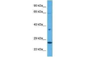 Host:  Rabbit  Target Name:  KL  Sample Tissue:  Human Jurkat Whole Cell  Antibody Dilution:  1ug/ml (Klotho anticorps  (N-Term))