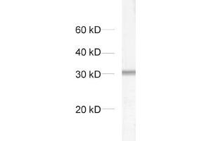 dilution: 1 : 1000, sample: crude synaptosomal fraction of rat brain (P2) (Syntaxin 6 anticorps  (AA 1-235))