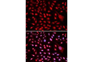 Immunofluorescence analysis of U2OS cells using CBFB antibody (ABIN6130041, ABIN6138000, ABIN6138001 and ABIN6220926).