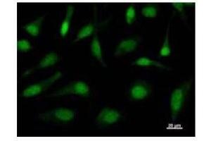 Immunostaining analysis in HeLa cells.