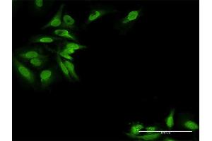 Immunofluorescence of purified MaxPab antibody to EPB41L2 on HeLa cell. (EPB41L2 anticorps  (AA 1-633))