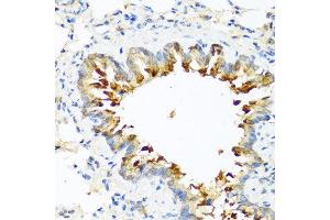 Immunohistochemistry of paraffin-embedded mouse lung using CPB2 antibody at dilution of 1:100 (40x lens). (CPB2 anticorps)