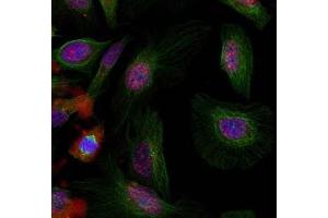 Image no. 3 for anti-Mdm2, p53 E3 Ubiquitin Protein Ligase Homolog (Mouse) (MDM2) (pSer166) antibody (ABIN401610) (MDM2 anticorps  (pSer166))