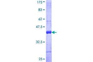 Fibulin 2 (FBLN2) (AA 1076-1184) protein (GST tag)