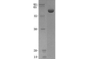 Validation with Western Blot