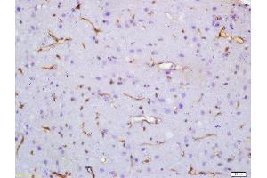 Formalin-fixed and paraffin embedded rat brain labeled with Anti-SV2A Polyclonal Antibody, Unconjugated  at 1:200 followed by conjugation to the secondary antibody and DAB staining (SV2A anticorps  (AA 451-550))
