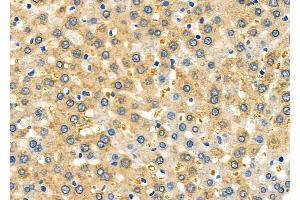 ABIN6264773 and ABIN6278630 at 1/100 staining Rat liver tissue by IHC-P. (URI1 anticorps  (Internal Region))