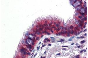 Human Lung, Respiratory Epithelium (formalin-fixed, paraffin-embedded) stained with BMPER antibody ABIN462252 followed by biotinylated goat anti-rabbit IgG secondary antibody ABIN481713, alkaline phosphatase-streptavidin and chromogen.