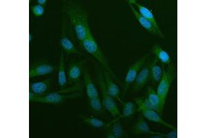 IF analysis of WDR1 using anti-WDR1 antibody (ABIN4886763).