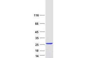 Adenine Phosphoribosyltransferase (APRT) (Transcript Variant 1) protein (Myc-DYKDDDDK Tag)
