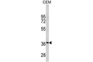 Western blot analysis of MPZ Antibody (C-term) in CEM cell line lysates (35ug/lane). (MPZ anticorps  (C-Term))