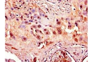 Immunohistochemistry of paraffin-embedded human placenta tissue using ABIN7150038 at dilution of 1:100