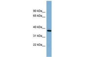 Image no. 1 for anti-XiAP Associated Factor 1 (XAF1) (AA 107-156) antibody (ABIN6742002) (XAF1 anticorps  (AA 107-156))