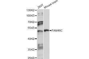 Western blot analysis of extracts of various cell lines, using FAM46C antibody (ABIN6292917) at 1:1000 dilution. (FAM46C anticorps)
