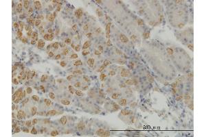 Immunoperoxidase of monoclonal antibody to AATK on formalin-fixed paraffin-embedded human stomach. (AATK anticorps  (AA 161-260))