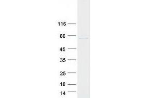 Validation with Western Blot