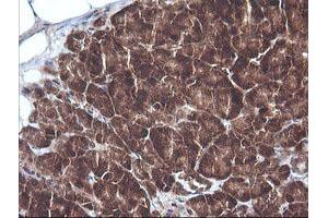 Image no. 3 for anti-Cancer/testis Antigen 1B (CTAG1B) antibody (ABIN1499895) (CTAG1B anticorps)