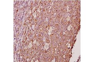Immunohistochemistry analyzes of AP20378PU-N Ephrin-A1 antibody in paraffin-embedded human tonsil carcinoma tissue at 1/50. (Ephrin A1 anticorps)