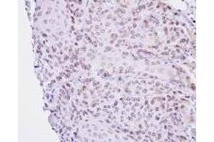 Immunohistochemistry: Lamin B2 antinbody staining of Paraffin-Embedded Cal27 Xenograft at 1/100 dilution. (Lamin B2 anticorps  (AA 221-460))