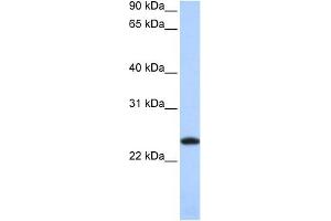 WB Suggested Anti-FTL Antibody Titration: 0. (FTL anticorps  (Middle Region))