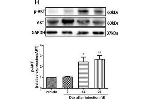 The CXCR7 and PI3K/Akt signaling pathways are involved in CPSP in the dorsal horn of the spinal cord. (GAPDH anticorps)