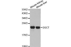 Western Blotting (WB) image for anti-gamma-Glutamylcyclotransferase (GGCT) antibody (ABIN1876220)
